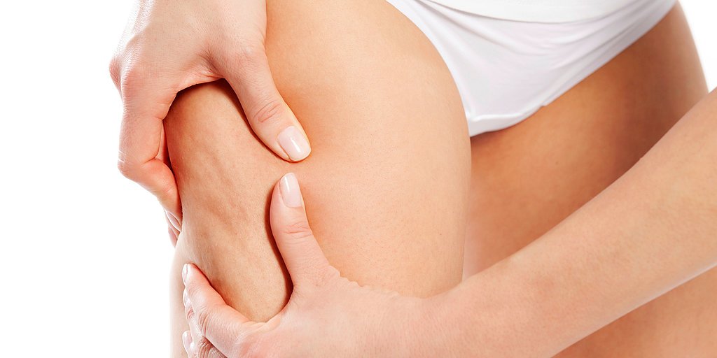 cellulite fibreuse symptômes