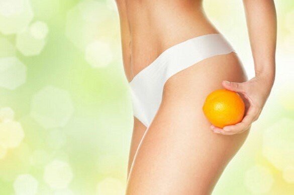 Cellulite1