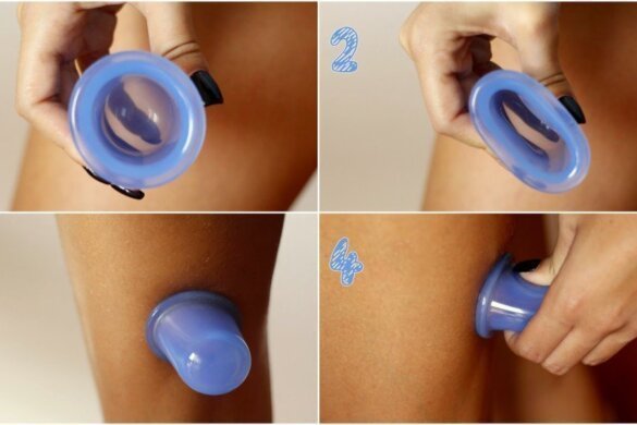 Capitons incrustés : la technique de massage avec la Ventouse Cellublue