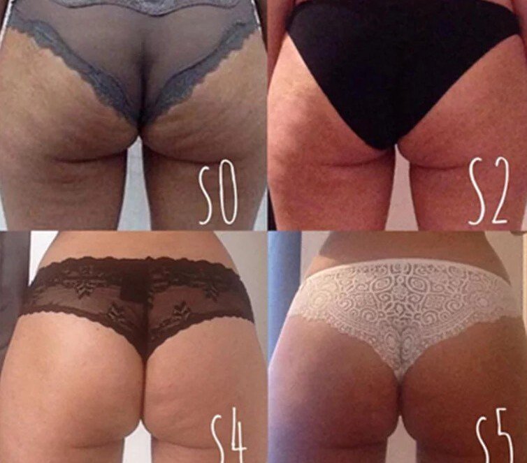 resultados CelluBlue