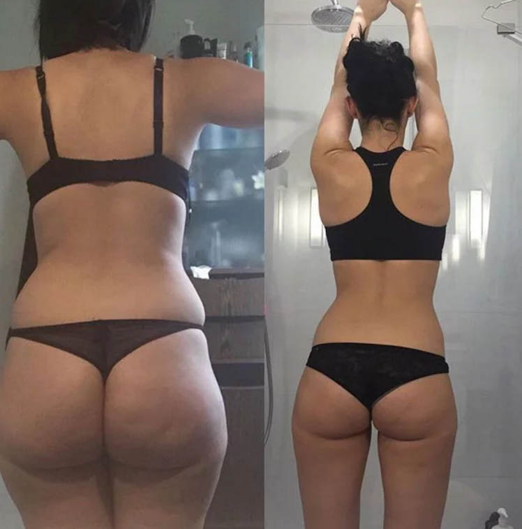 resultat ventouse anti cellulite cellublue