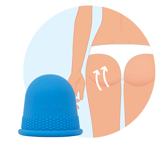 Etape 1 ventouse fesses copie