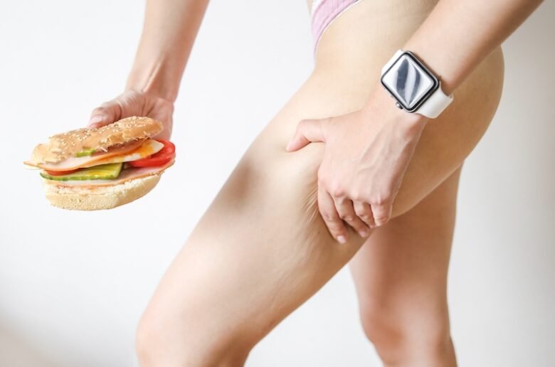 Fast food et cellulite