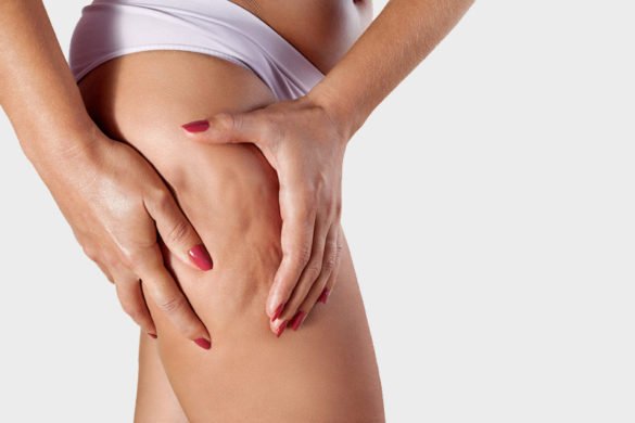 Cellulite on the thighs: everyday habits and care options