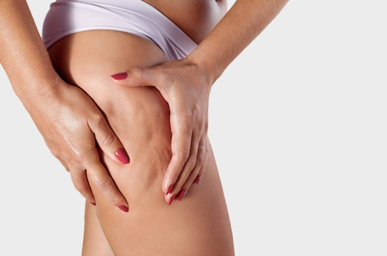 Cellulite sur les cuisses