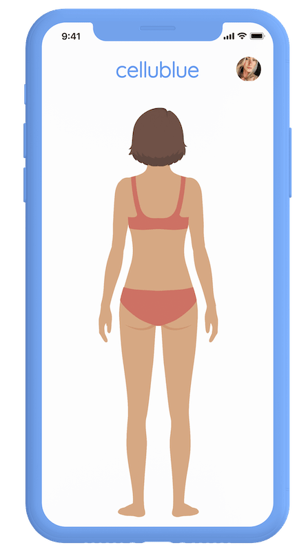 photo avant apres de dos