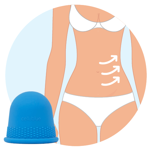 Ventouse anti cellulite sur le ventre