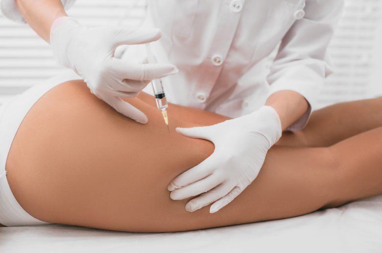Mésothérapie contre la cellulite