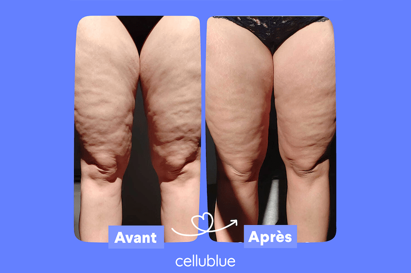 avant apres produit cellublue