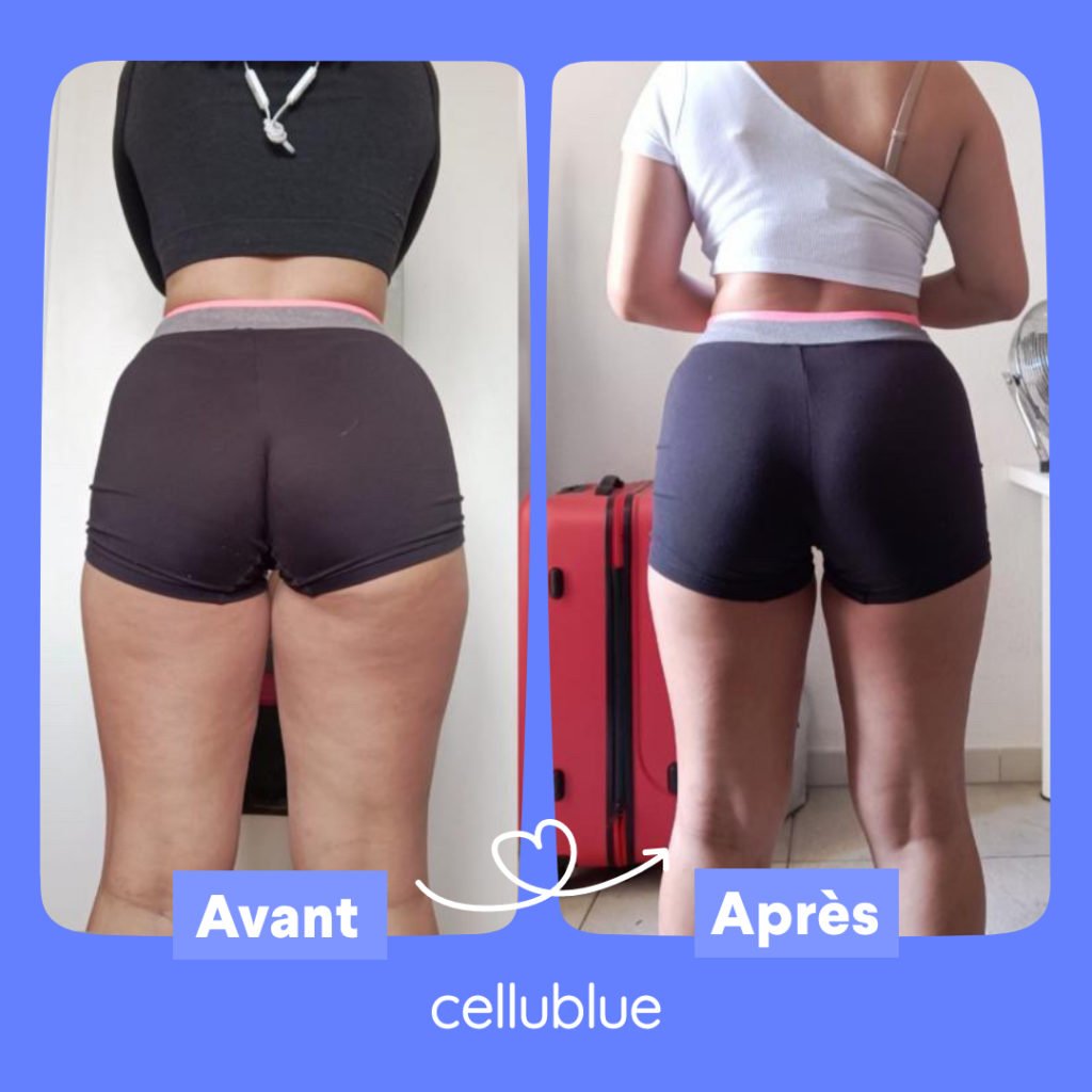 avant apres produits cellublue