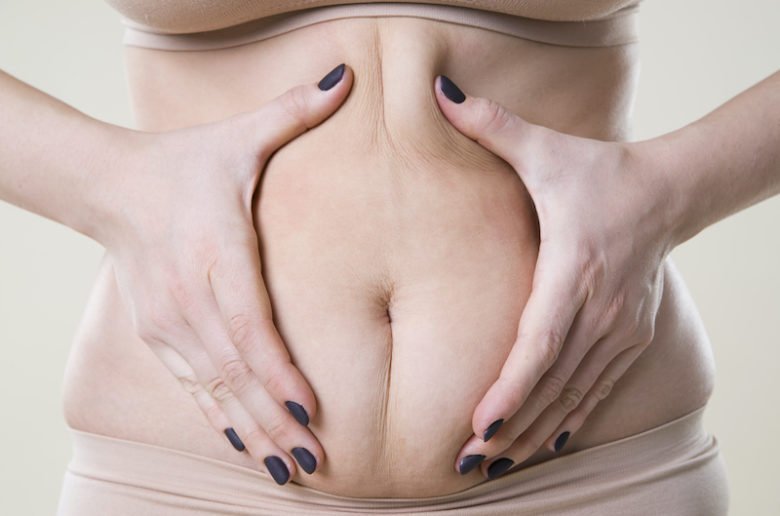 Ménopause et cellulite sur le ventre