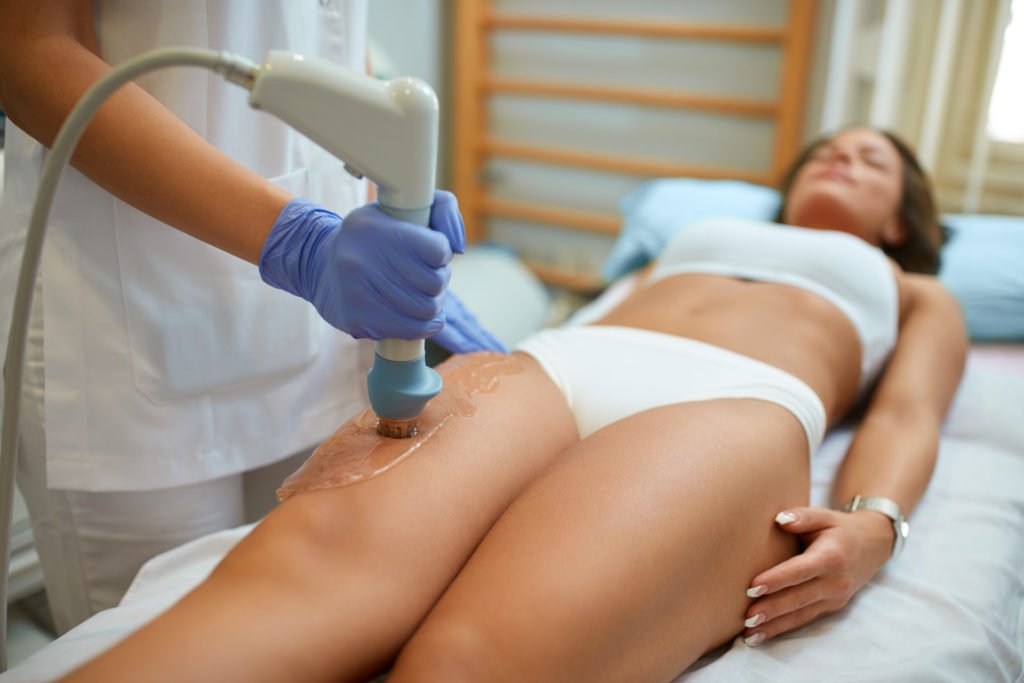 Tratamiento anticelulitis con ondas de choque (contra la celulitis incrustada)