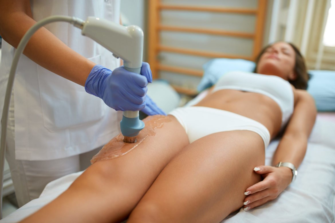 Ondes de choc cellulite