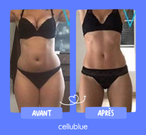 avant apres cellublue