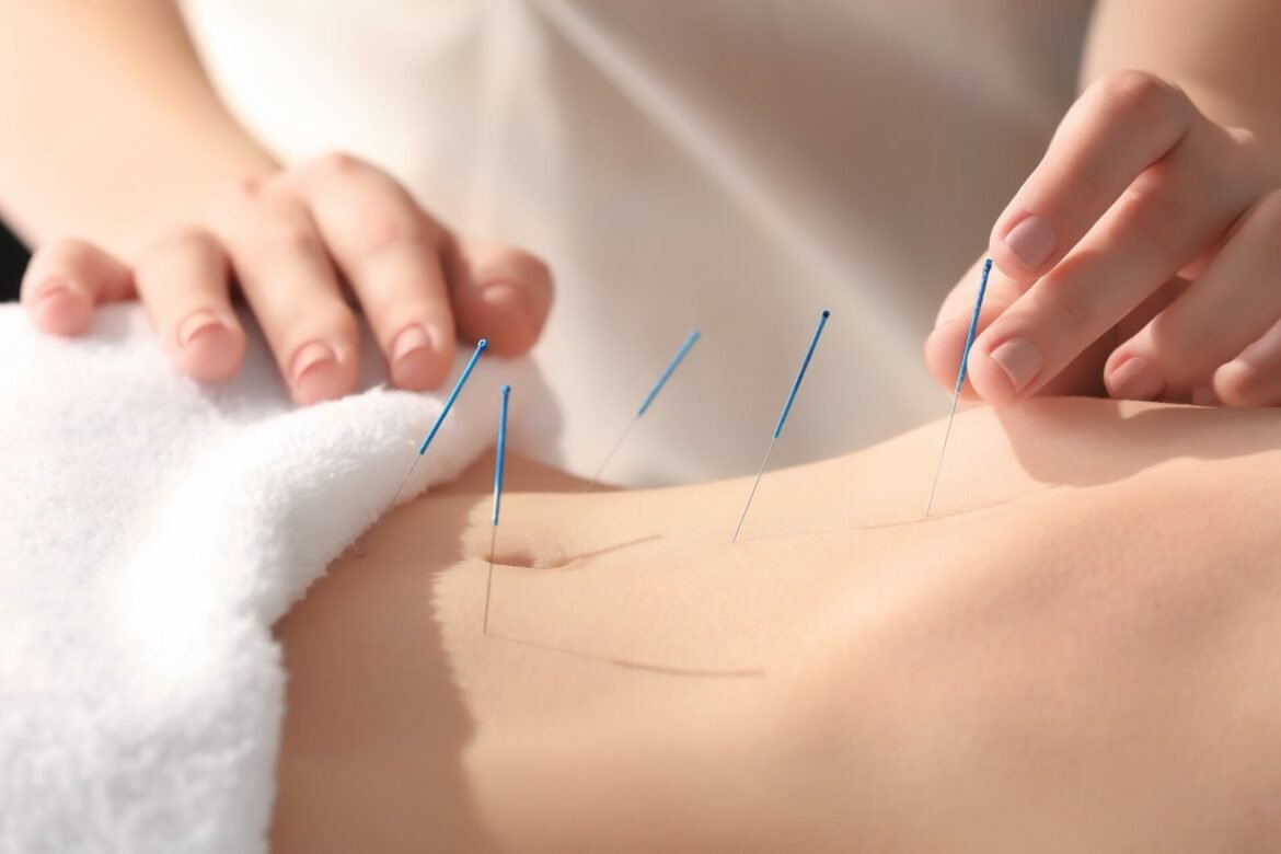 Acupuncture cellulite