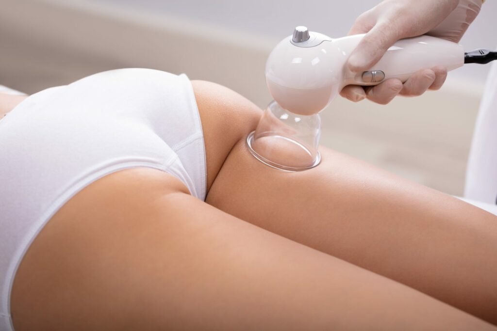 The anti-cellulite vacuum: how does it work?