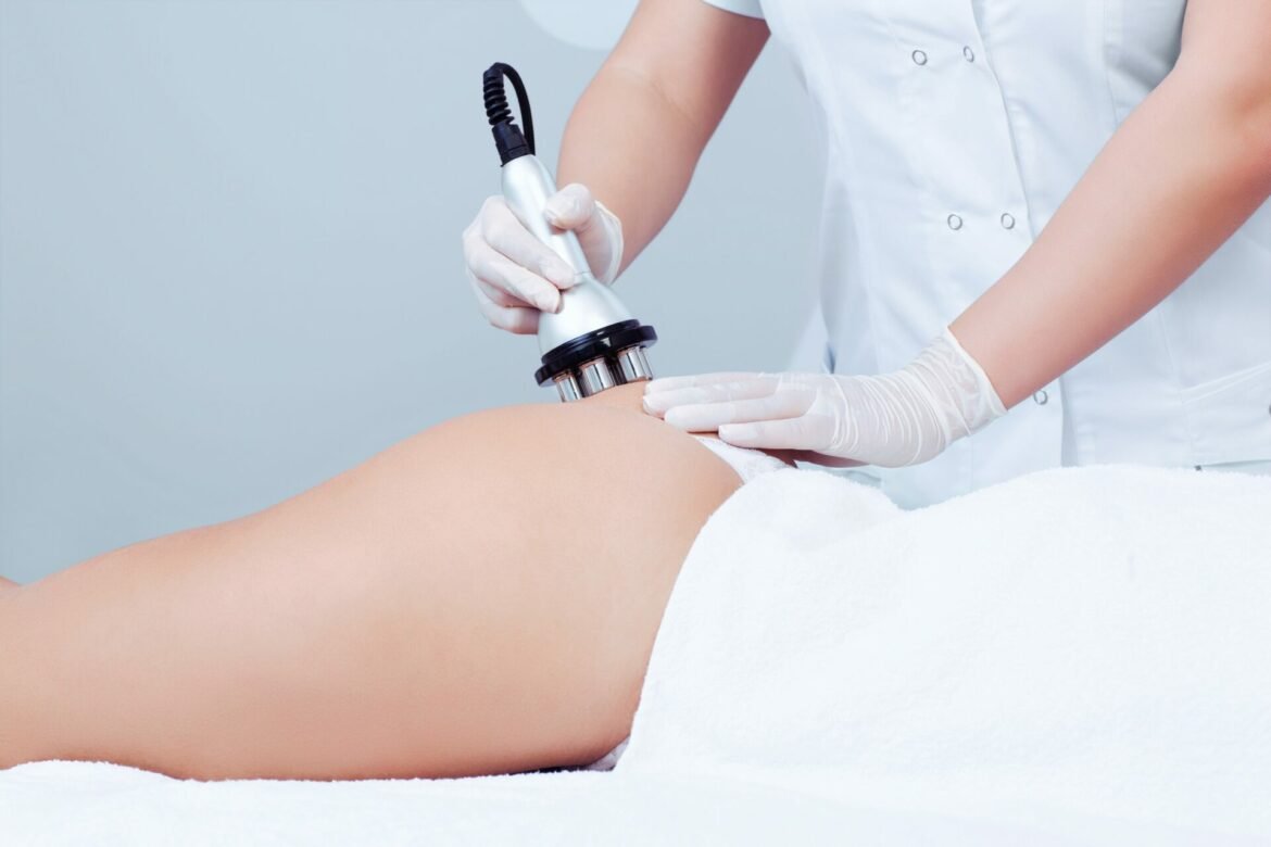 Traitement cellulite prix