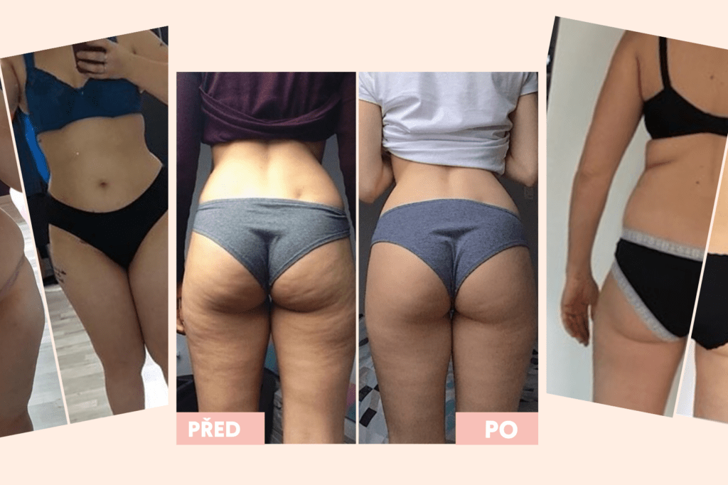 PŘED/PO: Proměny našich klientů s Cellublue - Avant après cz