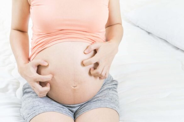 Itchy belly during pregnancy: what should you do?