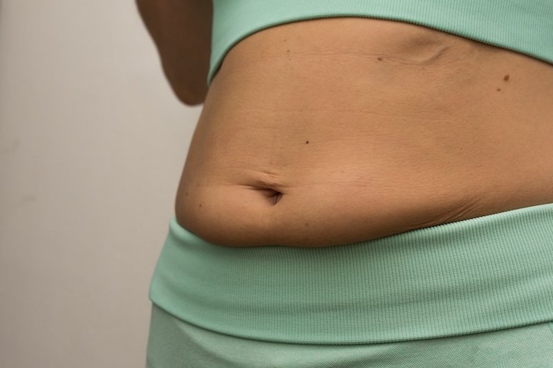 Ventre flasque après accouchement