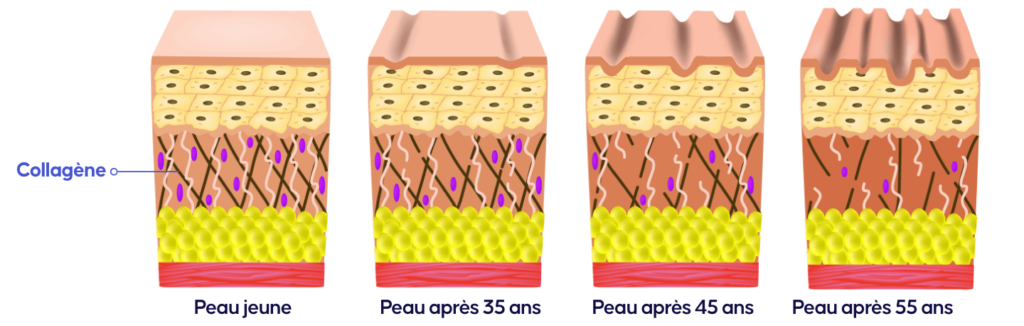 evolution du collagene