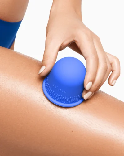Anti-Cellulite Cupping